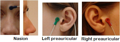 Figure 1: Approximate position of the Inion and preauricular points (figure downloaded from https://neuroimage.usc.edu/brainstorm/CoordinateSystems).