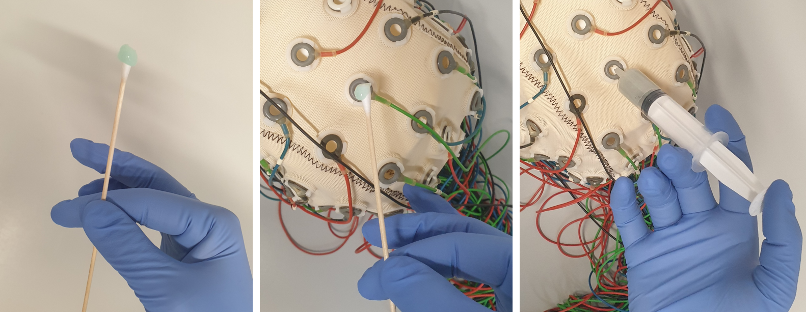 Figure 4: Skin preparation and gel application